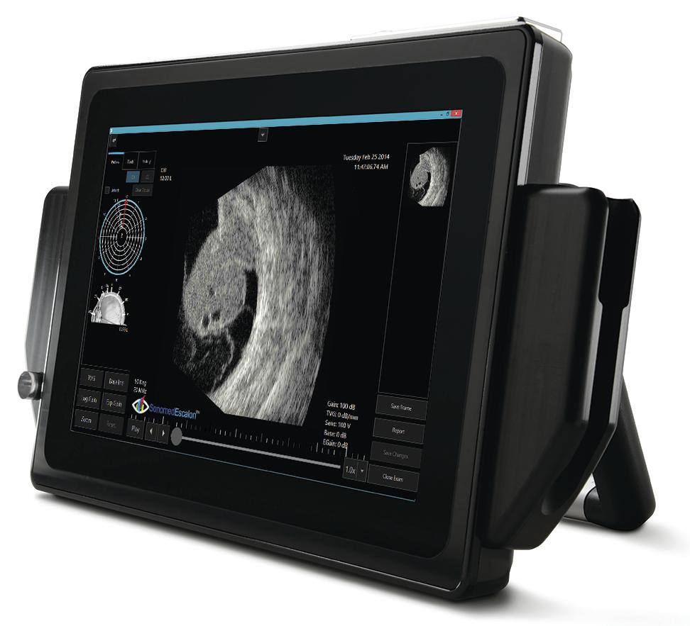 Vupad A /AB Scan + Pachymètre (B-Scan 12 MHz)
